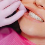 Help! I have loose teeth – what should I do?