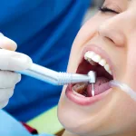5 Signs You Need a Dental Filling: Don’t Ignore These Warning Signals